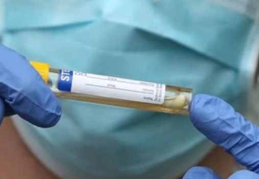 Johnson Announces Four Weeks Lockdown for England by Raphael Bichene